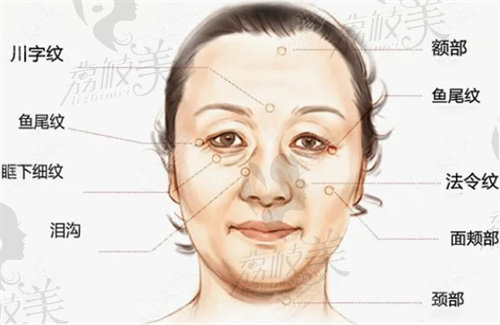 国内拉皮手术医生排名公布，都是面部提升最好的专家