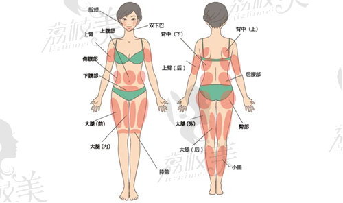 郭光烨医生所说的吸脂各部位