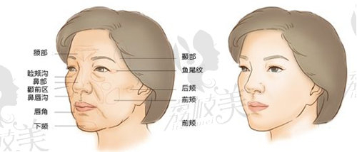 任贝贝医生面部填充范围变化