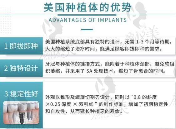 美国种植牙优势