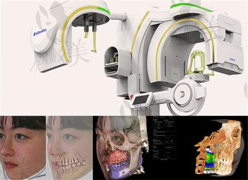 韩国1%的整形外科数字化模拟