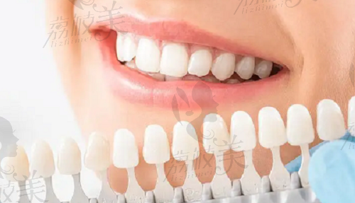 重庆牙卫士口腔和牙博士口腔哪家好？要从规模/医生和收费多方面分析