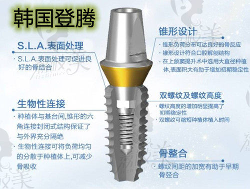 韩国登腾种植牙