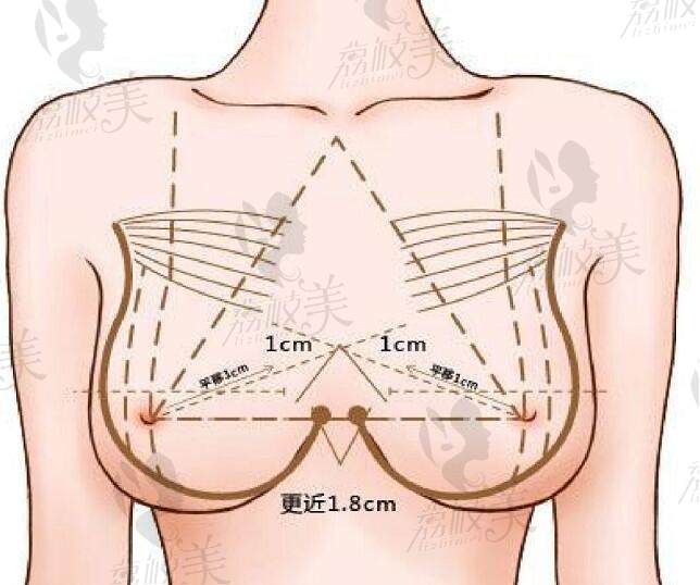 正常健康状态的乳房