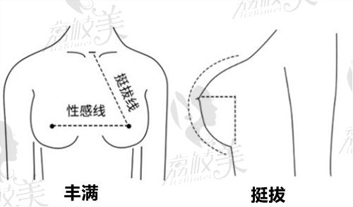 金华瑞丽整形医院脂肪隆胸审美