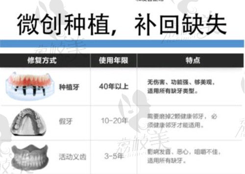 漳州种植牙价格