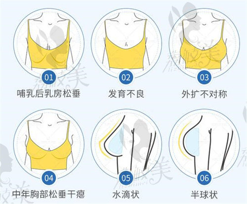 胸部各类情况