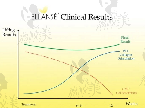 伊妍仕（Ellanse）代谢过程