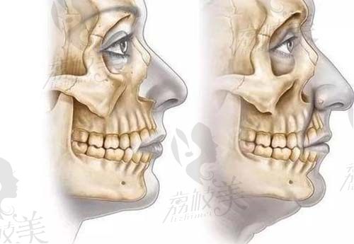 3d打印鼻基底骨骼图