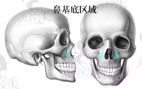 3d打印鼻基底位置显示图