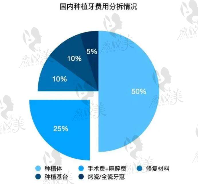 国内种植牙拆分情况