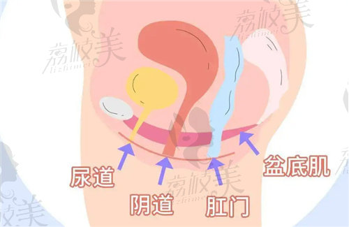 3D生物束帶緊縮術(shù)有后遺癥嗎？