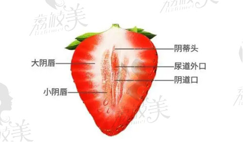 做了3D生物束带紧缩术的术后注意事项