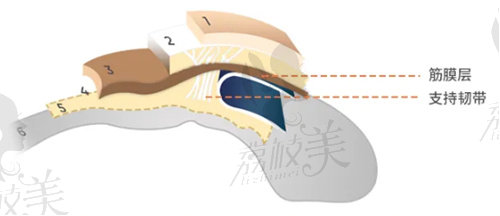 筋膜折叠提升术能够较好的作用于人体面部松弛