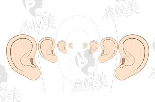 耳部轮廓示意图