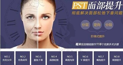 PST面部提升術