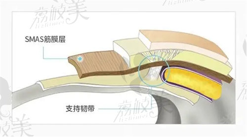 smas提升术和微创悬吊提升的区别