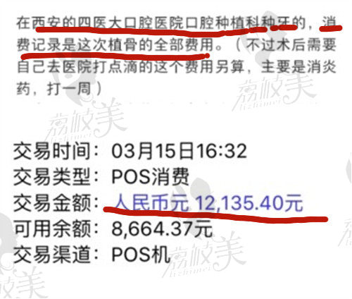 第四军医大学口腔科种植牙价格