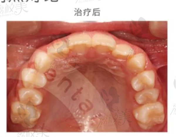 南京青苗口腔实例2