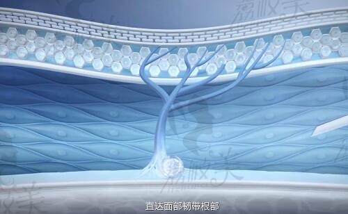 愛(ài)緹恩注射層次