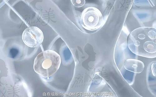 愛(ài)緹恩mADM功效