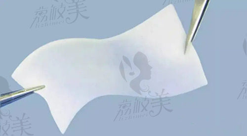 生物补片有啥作用