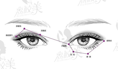 北京徐向民医生做双眼皮手术好吗