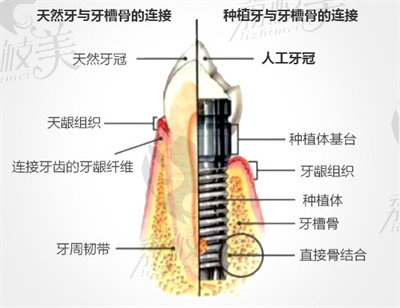 科特斯种植系统的特点和优势2