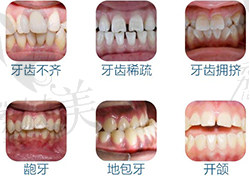 东莞贝壳美牙王景旭医生