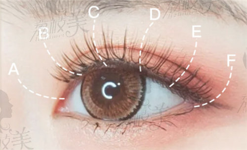 宁波鄞州薇琳眼整形技术好