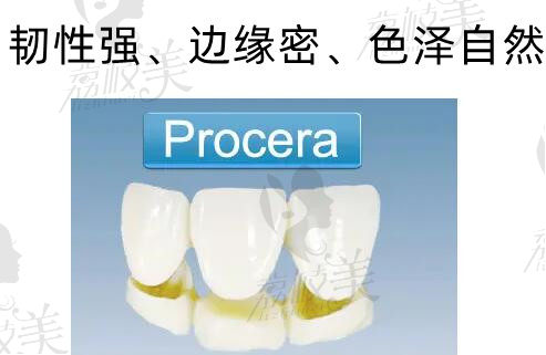 瑞典procera全瓷牙冠