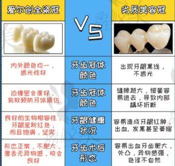 国产爱尔创全瓷牙冠