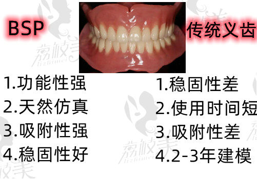 BPS吸附性義齒和傳統(tǒng)義齒區(qū)別