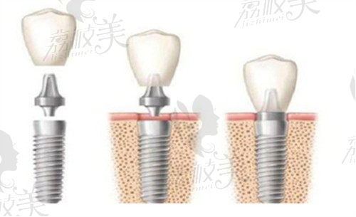 2022成都錦江貝臣口腔收費標準1