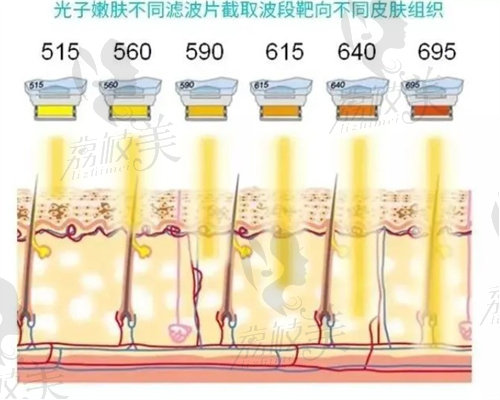 成都医大光子嫩肤示意图