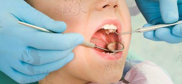 牙齿诊疗