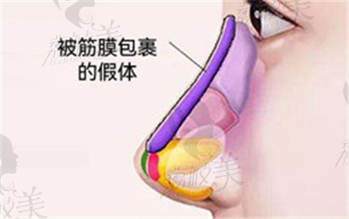 武汉五洲王志做鼻子技术不错