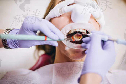 北京中诺第二口腔医院种植牙