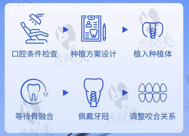 北京冠美平乐口腔种植牙流程