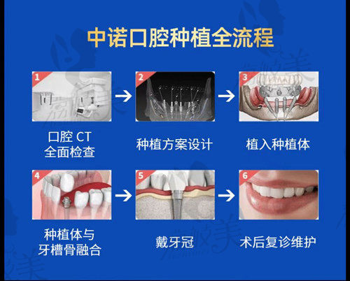 中诺口腔第二医院种植流程