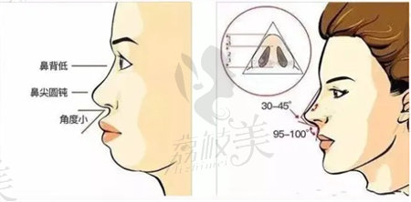 鼻部形态示意图