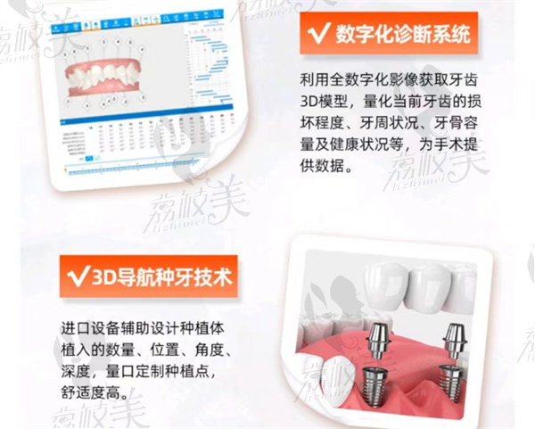 杭州薇琳口腔种植牙