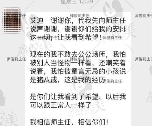 师俊莉做鼻子怎么样顾客反馈