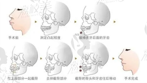 吳國(guó)平做正頜怎么樣？