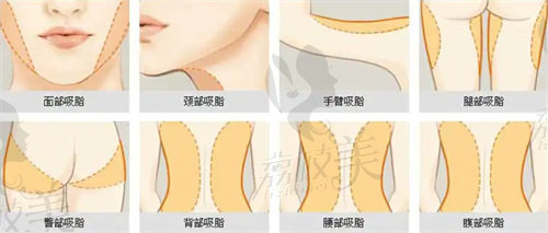 蘇州美貝爾快樂(lè)吸脂