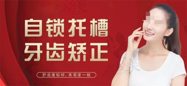 自锁托槽正畸牙齿矫正