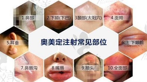 北京异物取出这四家医院,医生实力强,额头|面部|胸部异物价格公开