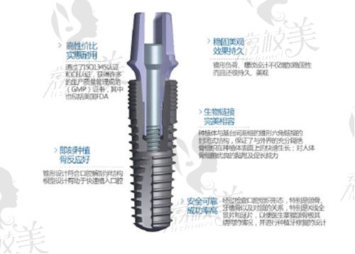 韩国登腾种植体