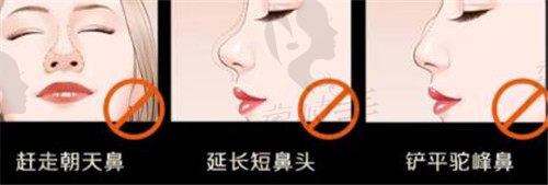 武汉艺星液态隆鼻不能做的鼻型