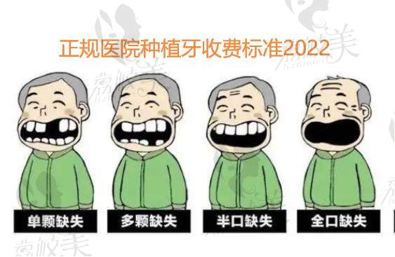 正规医院种植牙收费标准2022